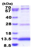 SDS-PAGE - Recombinant Human JTB protein (His tag N-Terminus) (AB183230)