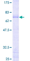 SDS-PAGE - Recombinant Human JunB protein (AB152484), expandable thumbnail