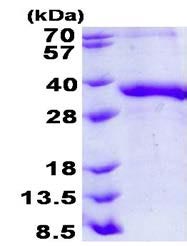SDS-PAGE - Recombinant Human Junctional Adhesion Molecule 2/JAM-B protein (denatured) (AB139237), expandable thumbnail