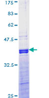 SDS-PAGE - Recombinant Human JunD protein (AB152486), expandable thumbnail