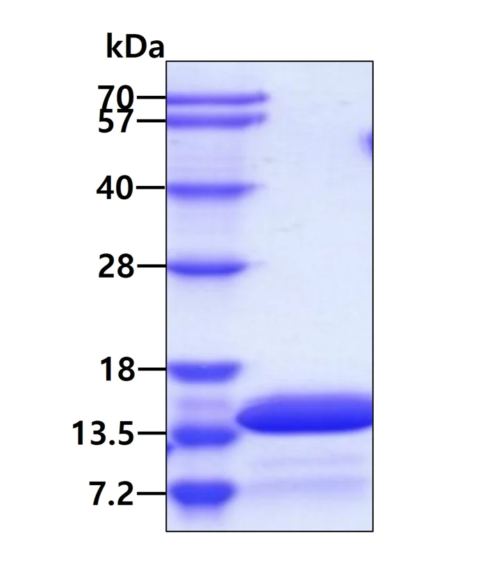 SDS-PAGE - Recombinant Human KAAG1 protein (AB105595)