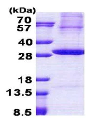 SDS-PAGE - Recombinant Human Kallikrein 2/KLK2 protein (denatured) (His tag N-Terminus) (AB167831)