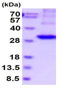 SDS-PAGE - Recombinant Human Kallikrein 2/KLK2 protein (His tag C-Terminus) (AB229375)