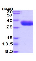 SDS-PAGE - Recombinant Human Kallikrein 5 protein (His tag C-Terminus) (AB224785)
