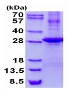 SDS-PAGE - Recombinant Human Kallikrein 7/KLK7 protein (denatured) (His tag N-Terminus) (AB134589)