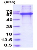 SDS-PAGE - Recombinant Human KAP1 protein (denatured) (His tag N-Terminus) (AB171679)