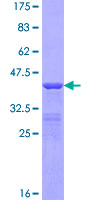 SDS-PAGE - Recombinant Human kappa + lambda protein (GST tag N-Terminus) (AB158749)