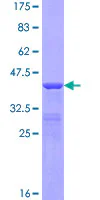 SDS-PAGE - Recombinant Human kappa + lambda protein (GST tag N-Terminus) (AB158749)