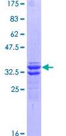 SDS-PAGE - Recombinant Human Kappa Opioid Receptor protein (AB114296), expandable thumbnail