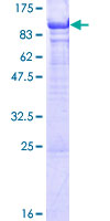 SDS-PAGE - Recombinant Human KASH5 protein (AB165568), expandable thumbnail