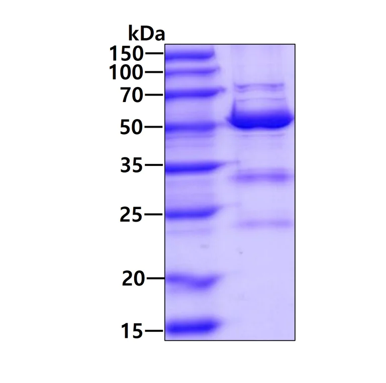 SDS-PAGE - Recombinant Human KAT2A / GCN5 protein (AB111648)