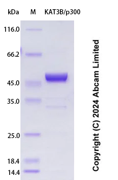 SDS-PAGE - Recombinant Human KAT3B/p300 Protein Standard (His tag) (AB323146)