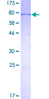 Recombinant Human KAT5 / Tip60 protein