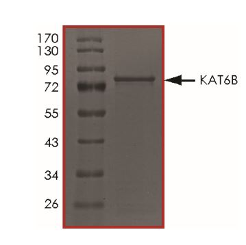 SDS-PAGE - Recombinant human KAT6B / MORF protein (Active) (AB268697), expandable thumbnail