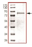 Recombinant Human KAT8 / MYST1 / MOF protein