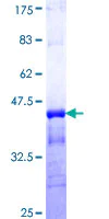 SDS-PAGE - Recombinant Human KCNC3 protein (AB158780)