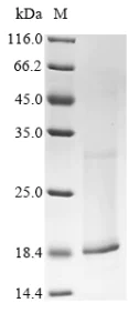 SDS-PAGE - Recombinant human KCNE2 protein (His tag) (AB314528)