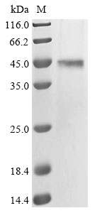 SDS-PAGE - Recombinant human KCNJ16 protein (His tag) (AB314527), expandable thumbnail
