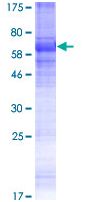 SDS-PAGE - Recombinant Human KCNK18/TRESK protein (AB132696)
