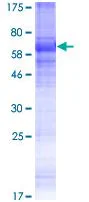 SDS-PAGE - Recombinant Human KCNK18/TRESK protein (GST tag N-Terminus) (AB132696)