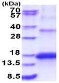SDS-PAGE - Recombinant Human KCNMB3 protein (denatured) (AB183227), expandable thumbnail