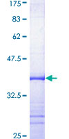 SDS-PAGE - Recombinant Human KCNN4 protein (GST tag N-Terminus) (AB158789)