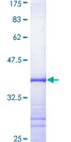SDS-PAGE - Recombinant Human KCNN4 protein (GST tag N-Terminus) (AB158789)