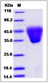 SDS-PAGE - Recombinant Human KCT2 protein (His tag) (AB276590)