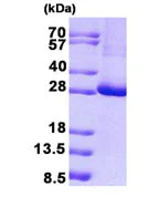 SDS-PAGE - Recombinant Human KCTD11/REN protein (denatured) (His tag N-Terminus) (AB140589)