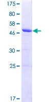 SDS-PAGE - Recombinant Human KCTD15 protein (AB132782)