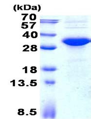 SDS-PAGE - Recombinant Human KCTD15 protein (denatured) (AB139203)