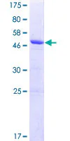 SDS-PAGE - Recombinant Human KCTD15 protein (GST tag N-Terminus) (AB132782)
