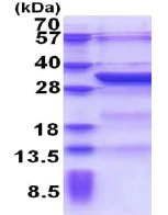 SDS-PAGE - Recombinant Human KCTD4 protein (AB174560)