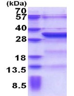 SDS-PAGE - Recombinant Human KCTD4 protein (His tag N-Terminus) (AB174560)