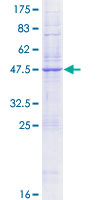 SDS-PAGE - Recombinant Human KDEL Receptor protein (AB153142), expandable thumbnail