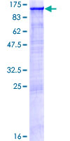 Recombinant Human KDM1/LSD1 protein