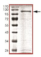 SDS-PAGE - Recombinant Human KDM2A protein (AB151923)