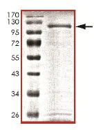 SDS-PAGE - Recombinant Human KDM2A protein (AB151923)