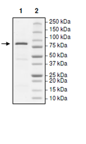 SDS-PAGE - Recombinant human KDM2A protein (Active) (AB271507)