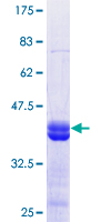 Recombinant Human KDM2B protein