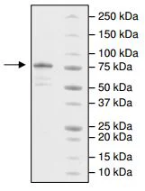 SDS-PAGE - Recombinant human KDM2B protein (DDDDK tag C-Terminus) (AB196435)