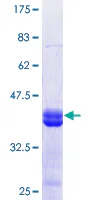 SDS-PAGE - Recombinant Human KDM2B protein (GST tag N-Terminus) (AB164635)