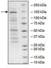 SDS-PAGE - Recombinant human KDM3A / JHDM2A protein (AB196411)