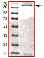 SDS-PAGE - Recombinant Human KDM4A / JHDM3A / JMJD2A protein (AB125541)