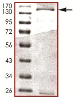 SDS-PAGE - Recombinant Human KDM4A / JHDM3A / JMJD2A protein (GST tag N-Terminus) (AB125541)