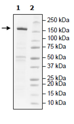 SDS-PAGE - Recombinant human KDM5B / PLU1 / Jarid1B protein (Active) (AB271567)