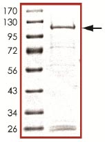 Recombinant Human KDM5C / Jarid1C / SMCX protein
