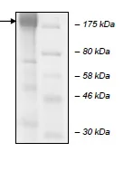 SDS-PAGE - Recombinant human KDM5C / Jarid1C / SMCX protein (DDDDK tag N-Terminus + His tag N-Terminus) (AB196392)