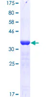 SDS-PAGE - Recombinant Human KDM6A / UTX protein (GST tag N-Terminus) (AB159790)