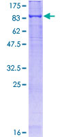 SDS-PAGE - Recombinant Human Keap1 protein (GST tag N-Terminus) (AB132384)